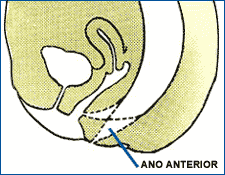 Corte sagital de anatomía femenina