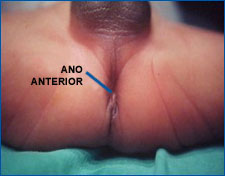 Ano anterior